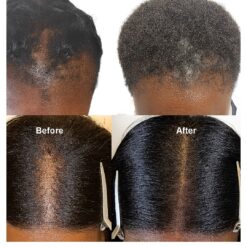 Pineapple Hair Growth Oil Bottle – Natural Treatment for Afro Hair Growth